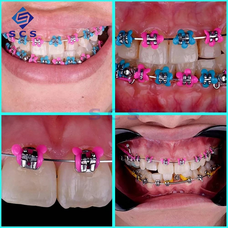 Dental Orthodontic Product Flexible Cartoon Colorful Elastic Dental Ligature Ties